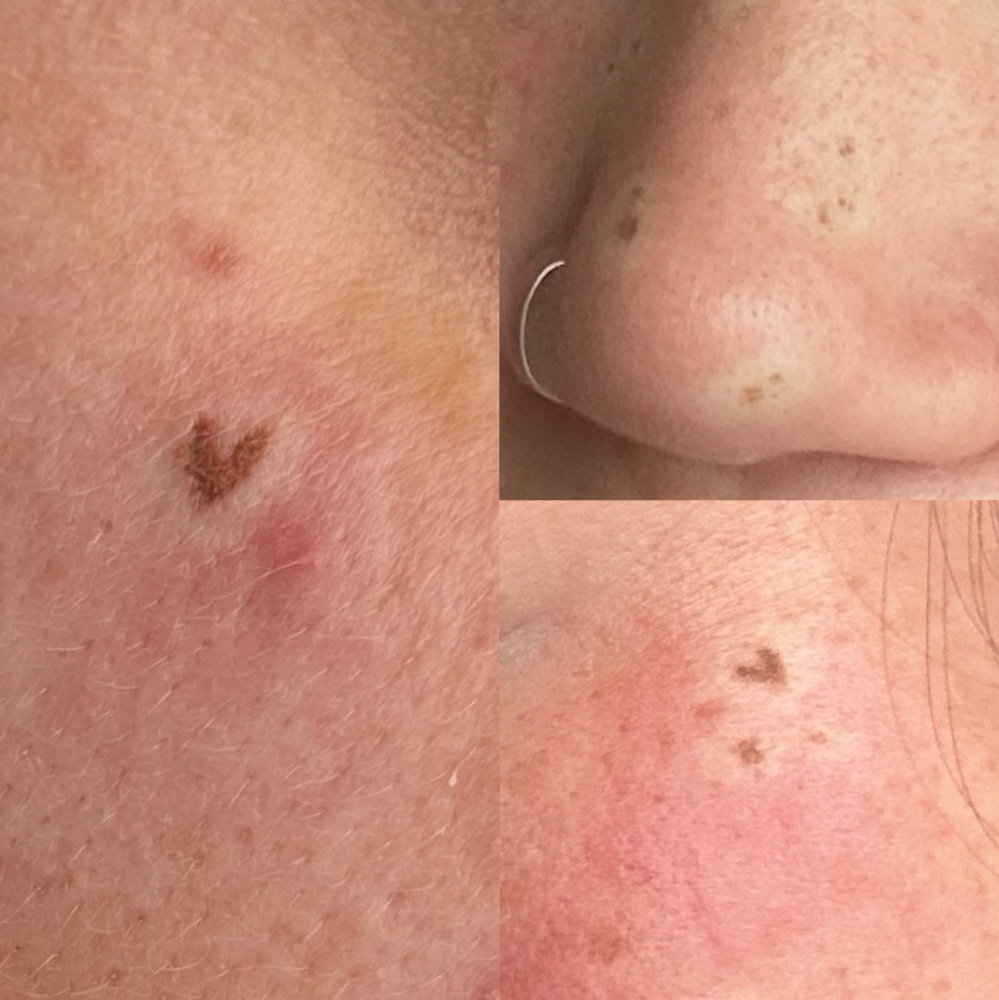 Heart Freckle Add-on at Lemon Lash @ FaceFrame Collective in Pittsfield, MA