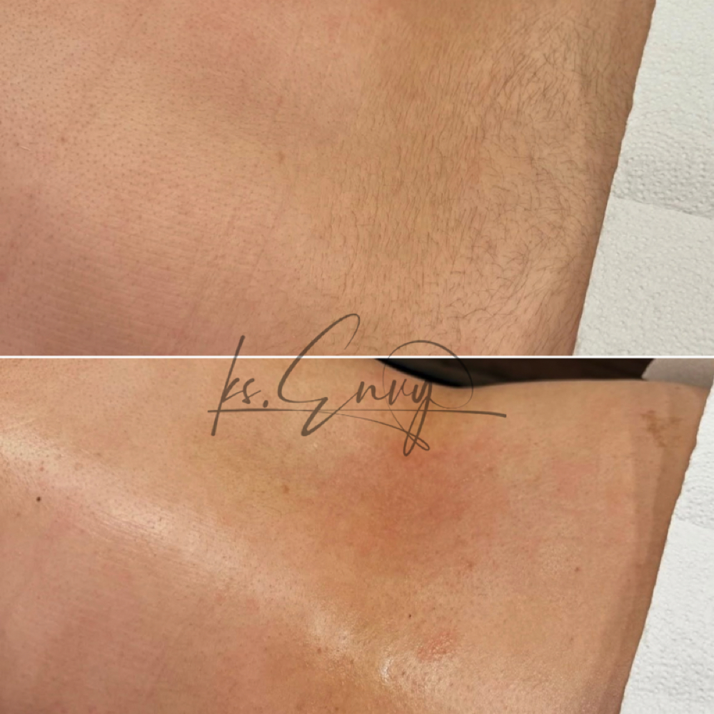 Back (Mid) at KS.Envy in Columbus, OH