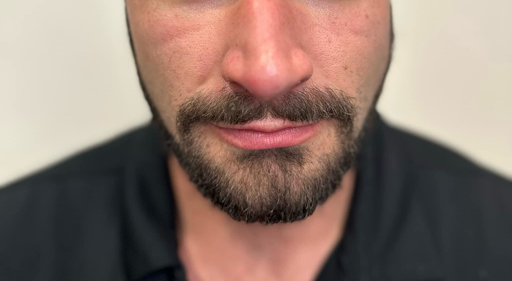 Beard Trim W/ Hot Towel