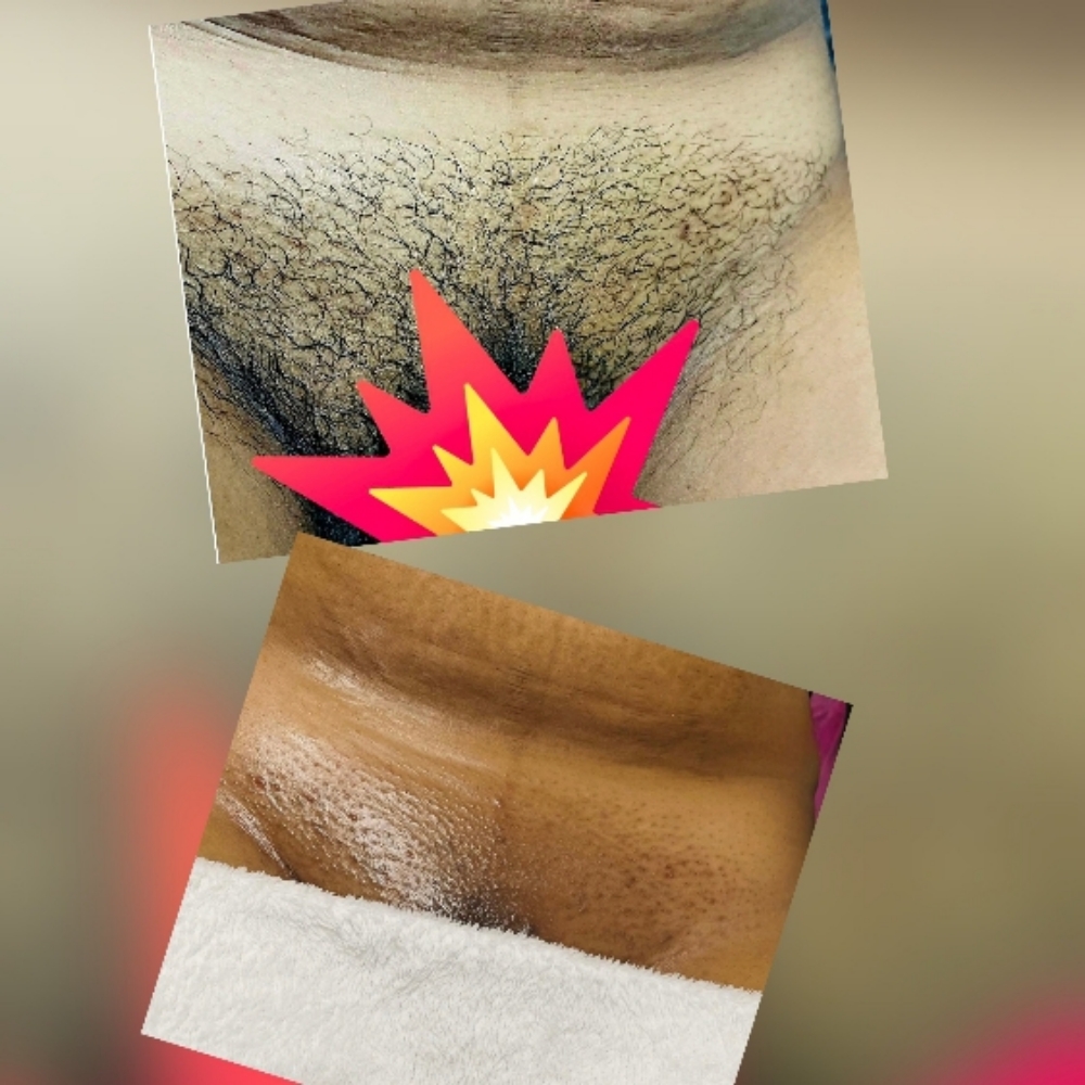Vajacial at Blissfully Radiant Esthetics in Valley-Stream, NY