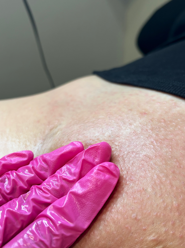 Brazilian Wax