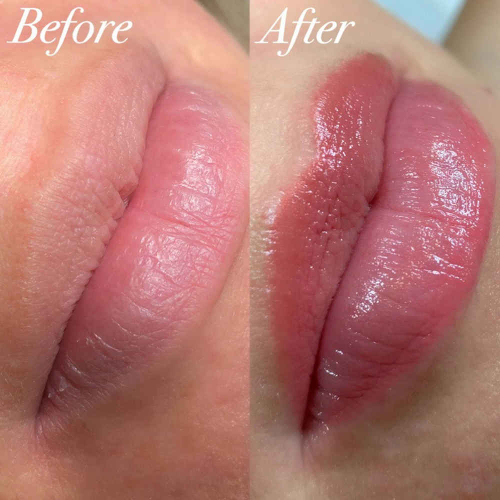 Lip Blushing at Rewind Med Spa in Longmont, CO