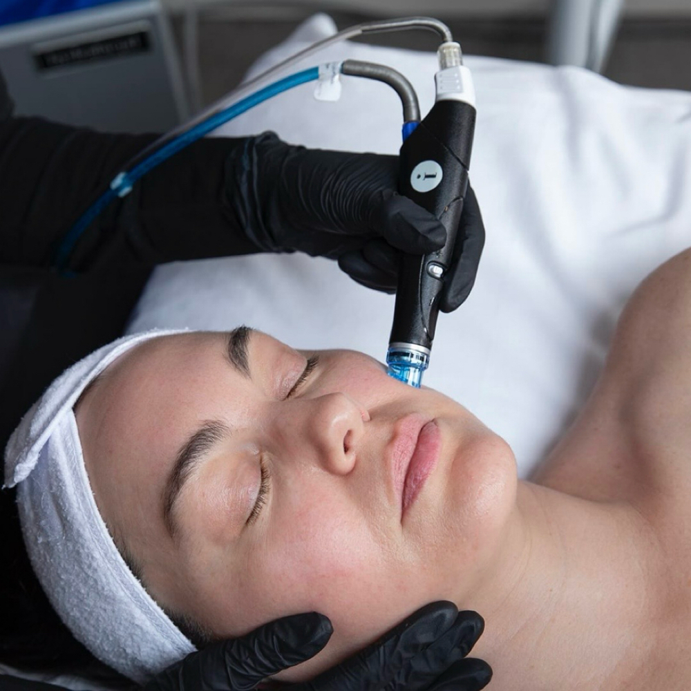 Hydrafacial at Luminous Aesthetics in Springdale, AR