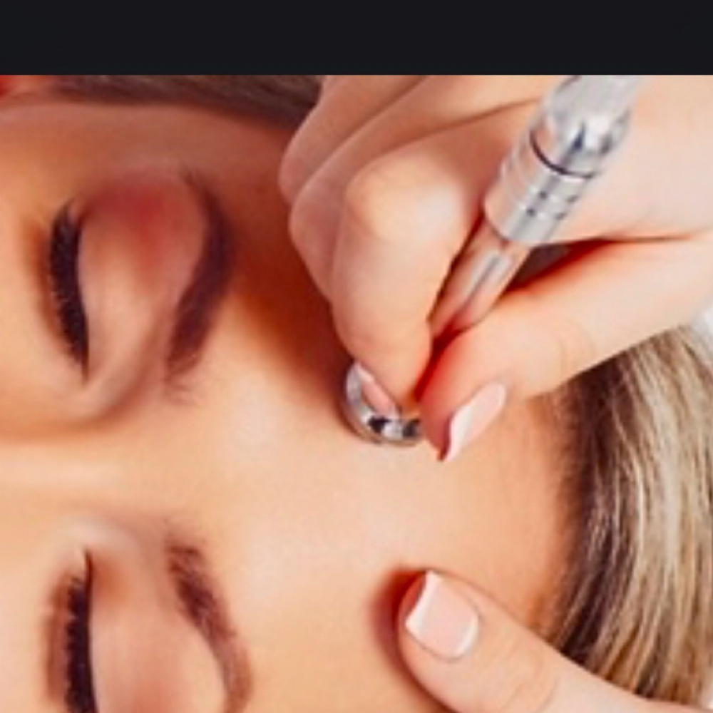 Microdermabrasion Facial at Sweet Dreams Spa in Bronx, NY
