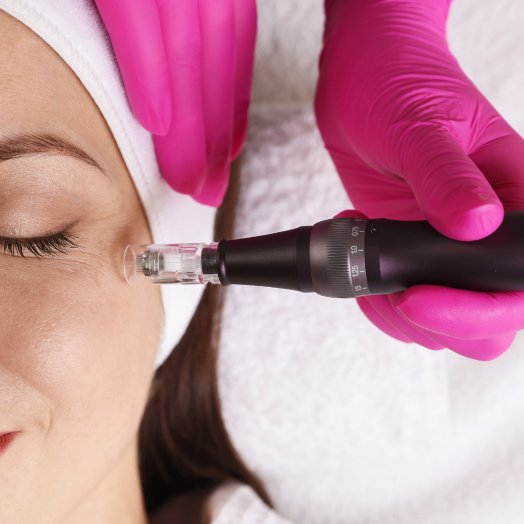 Exosome Therapy at De Bacco Esthetic in Morrow, GA