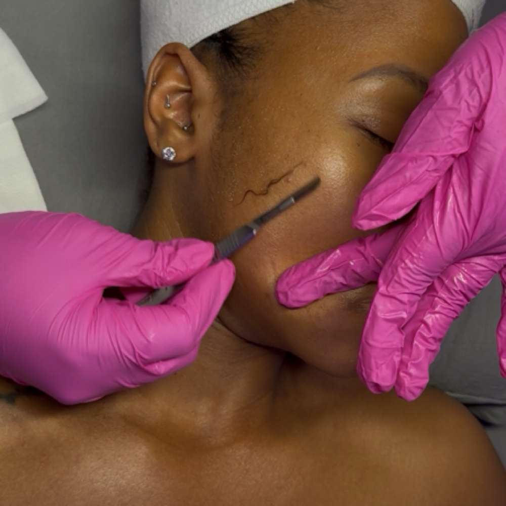 Express Dermaplaning at Devyne Esthetics in Louisville, KY