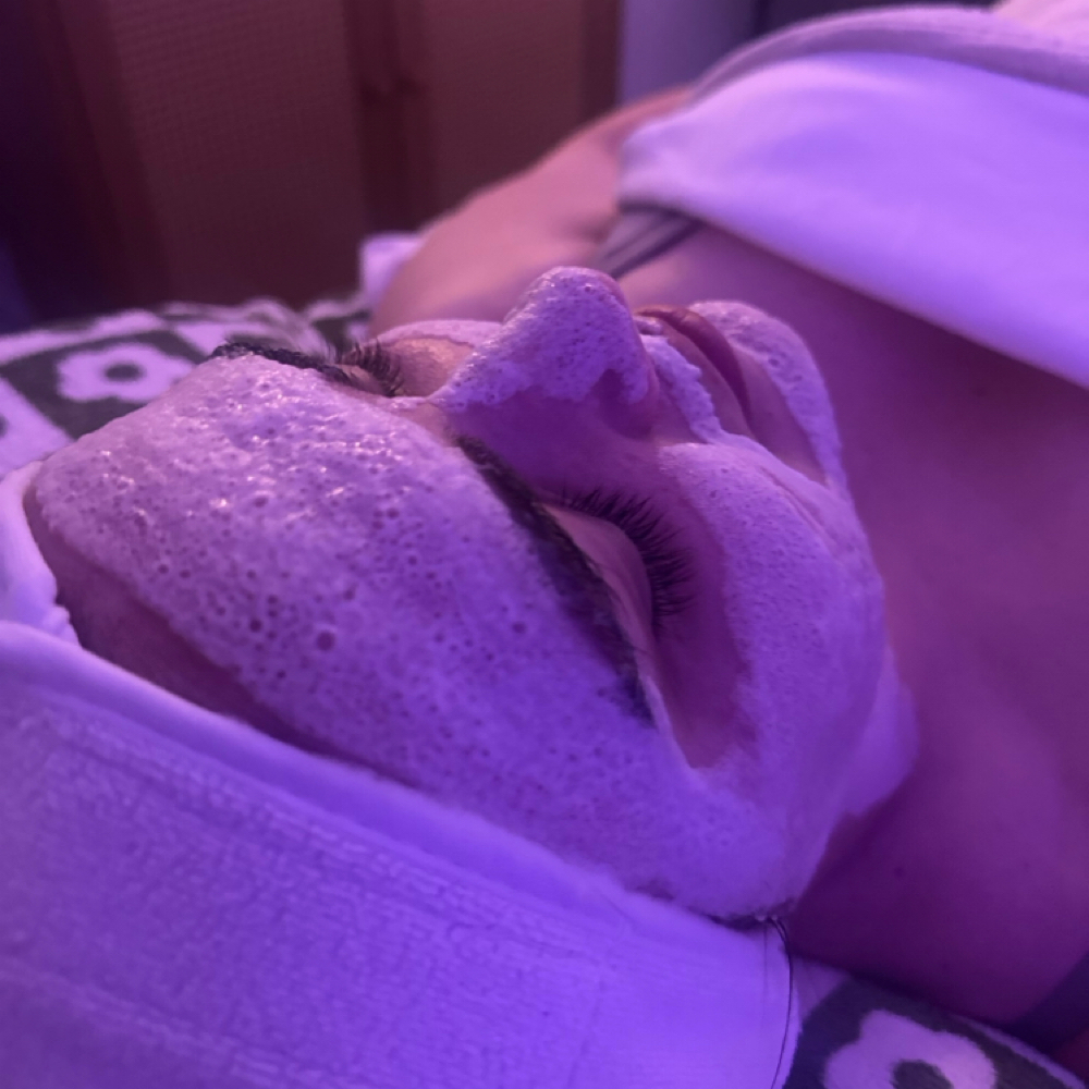 Dermathod O2 Tox Peel at Sunrise Glow Skin in Temple, TX