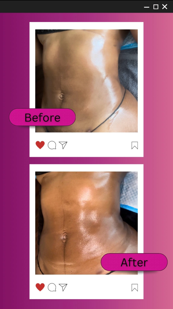 Lymphatic Pack 8