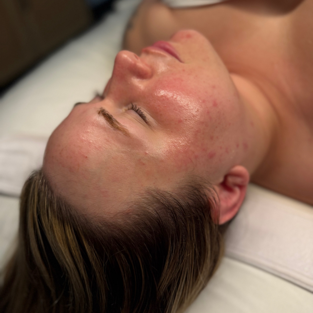 60 Min. Custom Facial at Aesthetically You in Bakersfield, CA