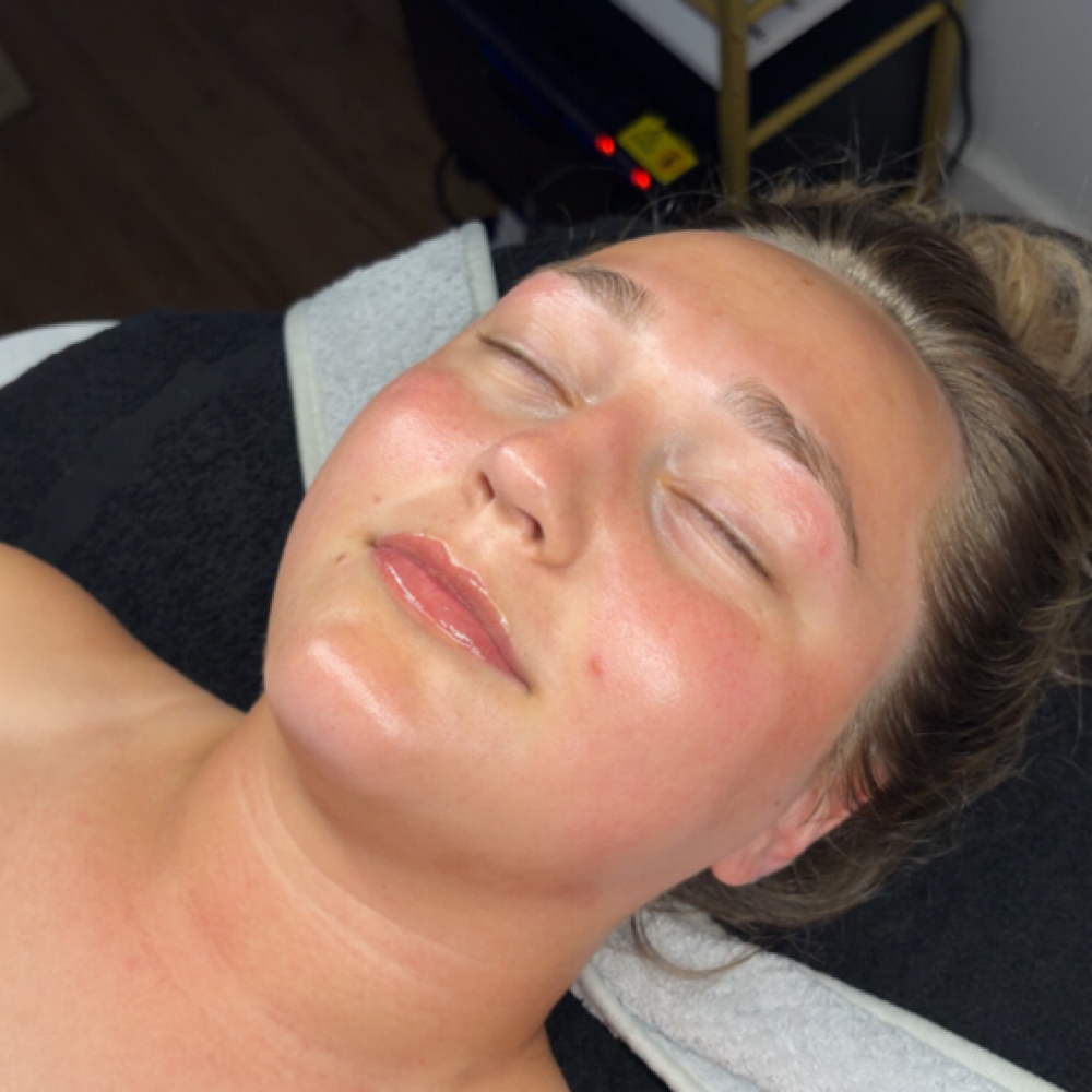 Dermaglow at Bae's Beauty Esthetics in Milan, TN