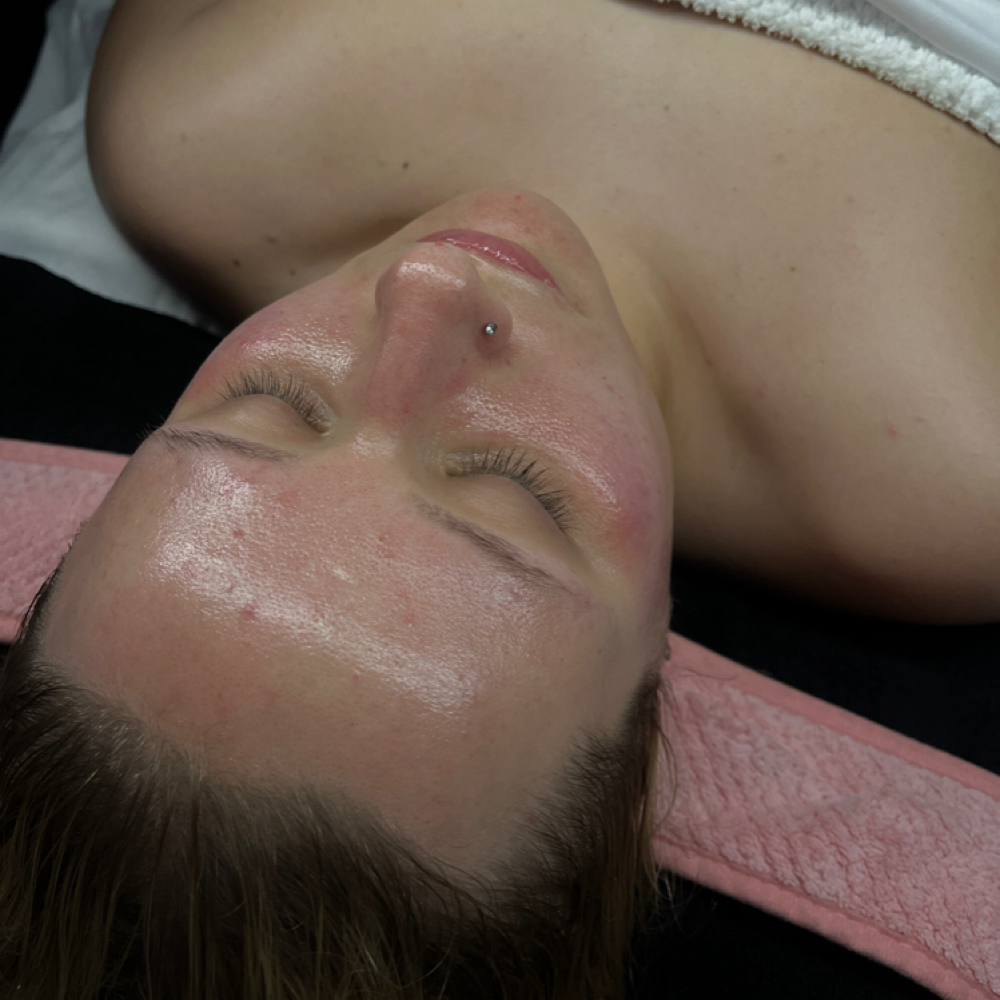 Dermaglow at Bae's Beauty Esthetics in Milan, TN