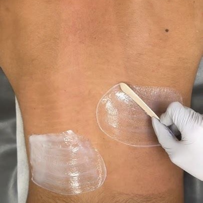 Full Back Wax at Pure Glow Esthetics in Fairport, NY