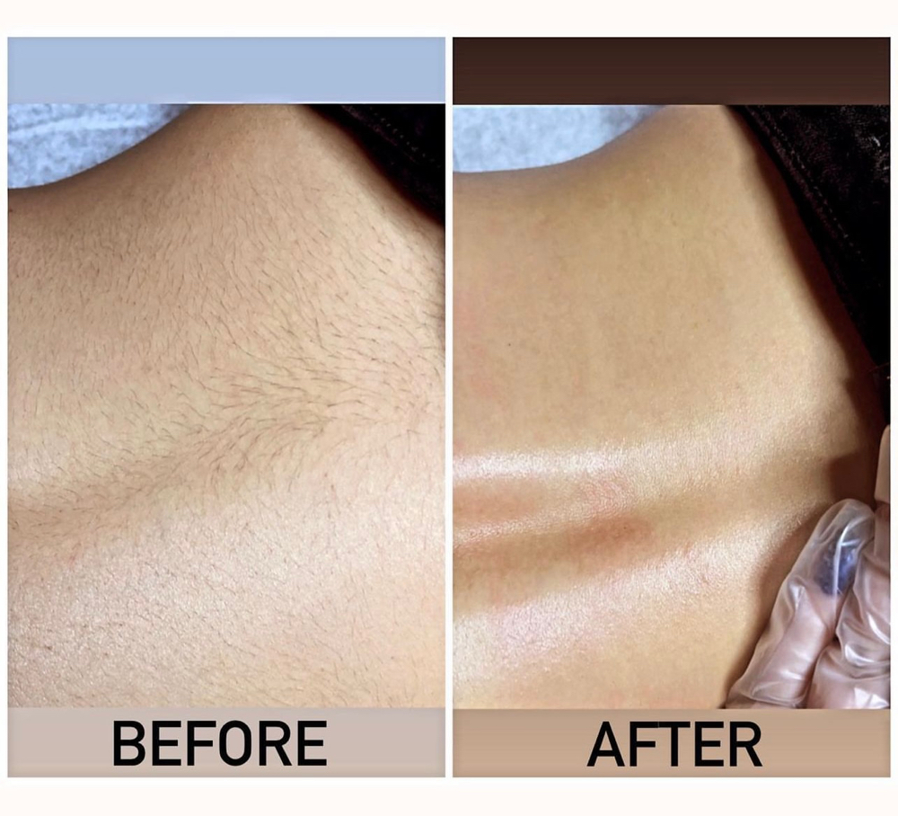 Chest / Back Wax