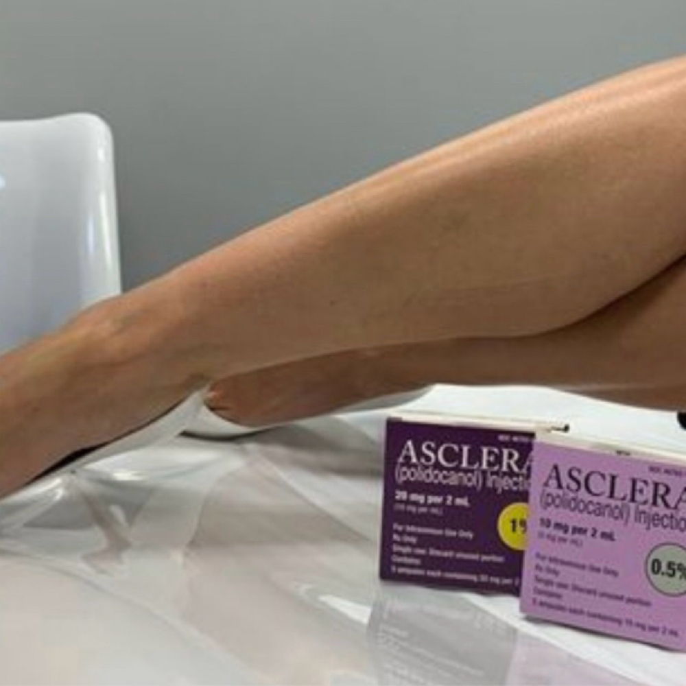 Aesclera Injections at Euphoria Skin & Hair in Goodyear, AZ
