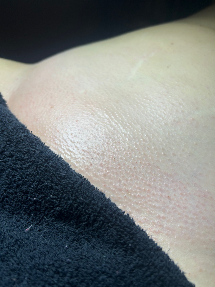 Brazilian Wax