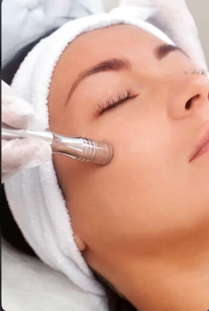 Microderbabrasion Facial