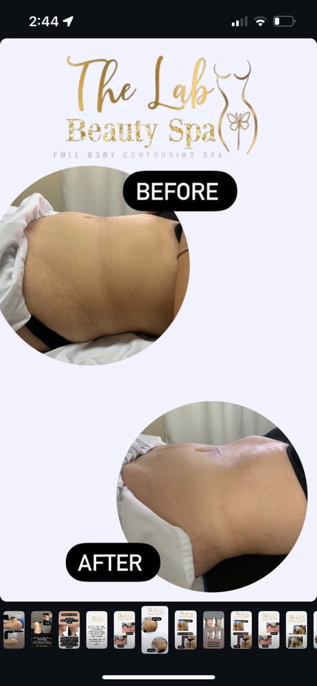 Woodtherapy 1 Sess. Body Part at The Lab Spa in Melbourne, FL