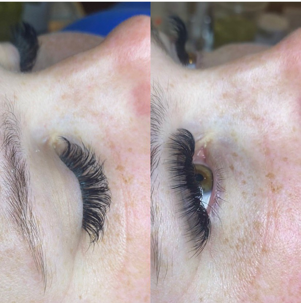 Hybrid Lash Set