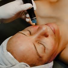 Hydrafacial