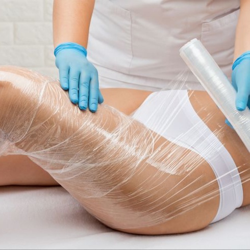 Anti-Cellulite Body Wrap with STYX at MILA STYLE Face&Body in Dallas, TX