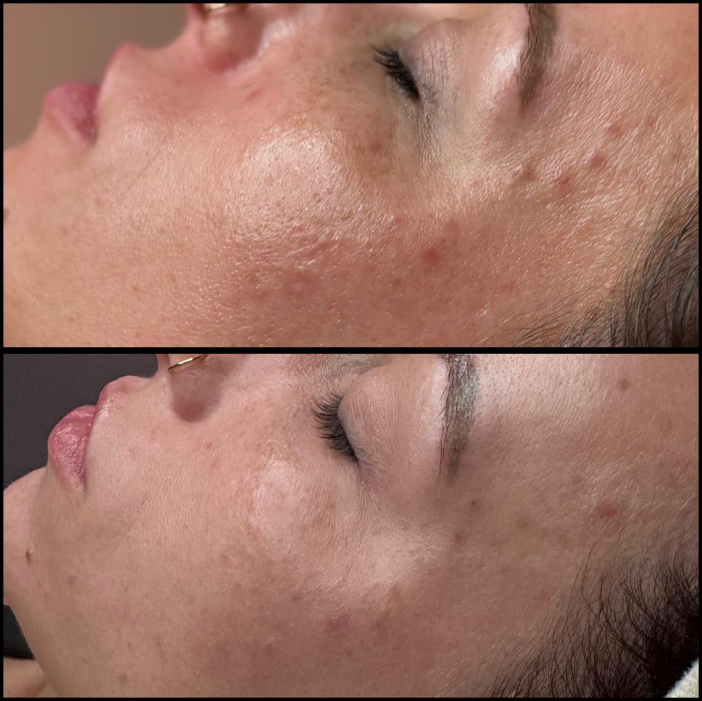 Smooth Operator Luxe