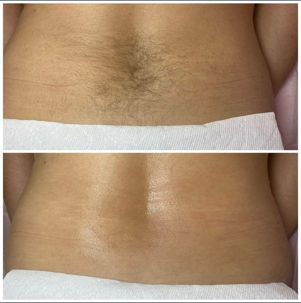 Lower Back Wax at Chosen Esthetics in Pasadena, TX