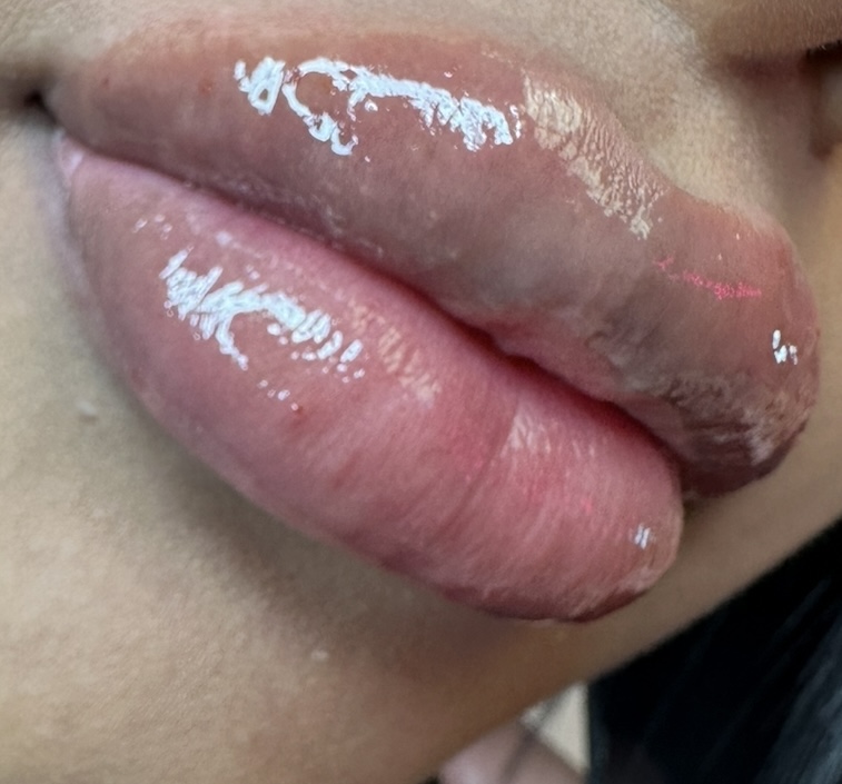 1.1ml New Client 💋✨