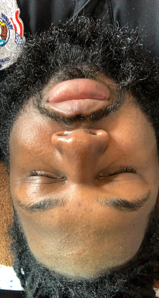 Beard Facial (Male Facial)