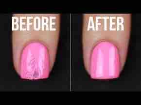 Nail Repair