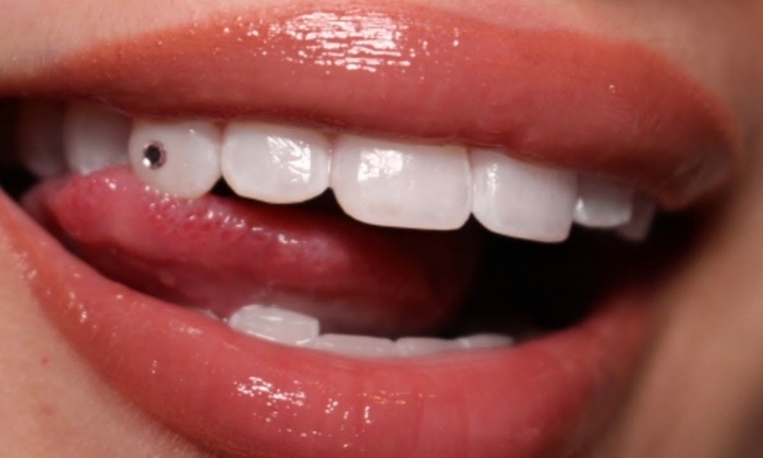 Swarvoski Tooth Gem