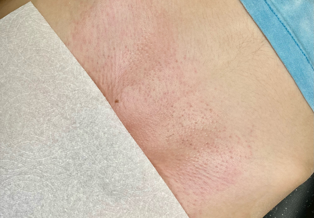 Brazilian Wax