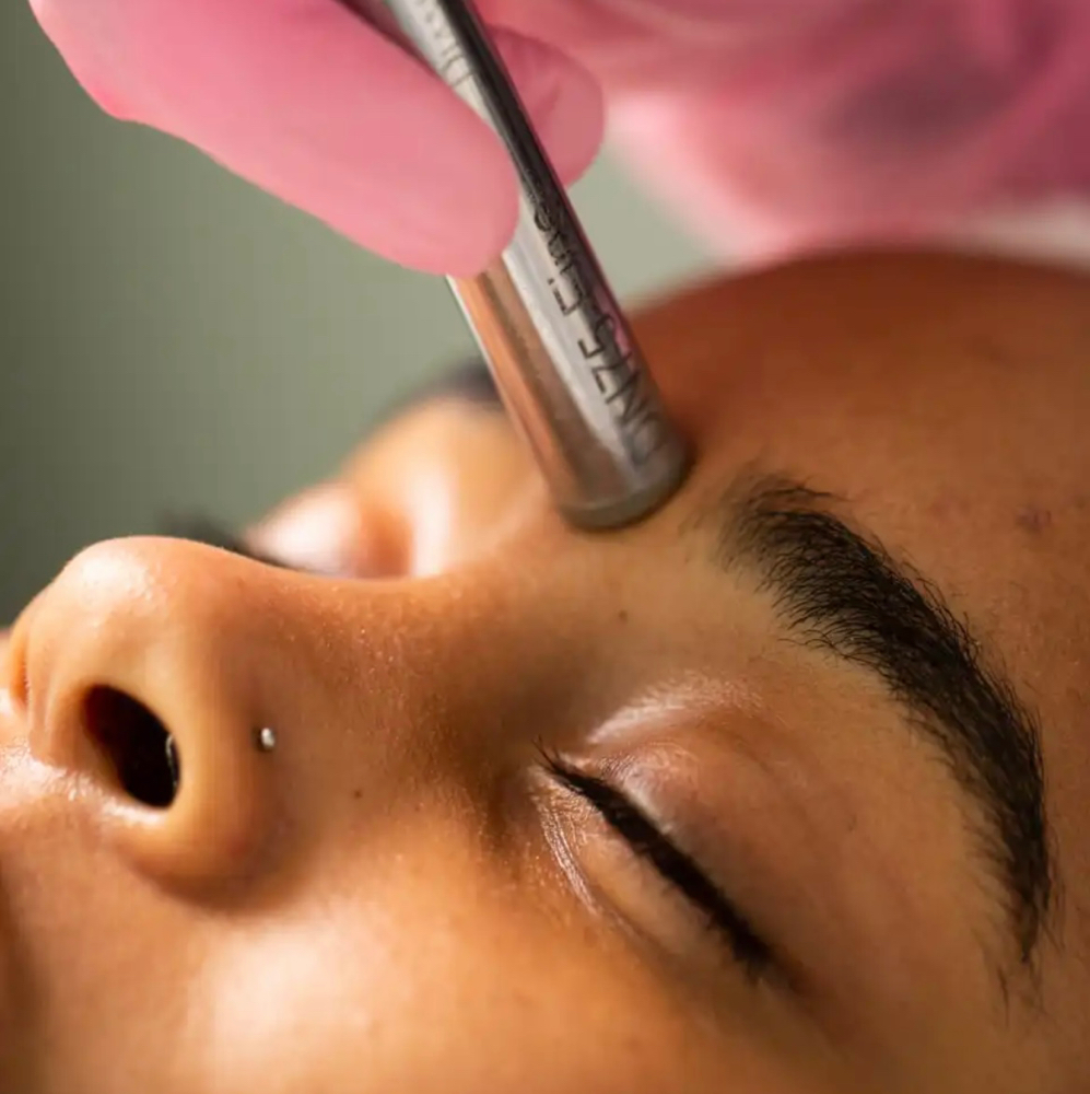 Microdermabrasion Facial