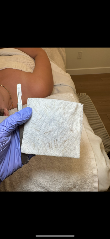 Dermaplane - ADD ON