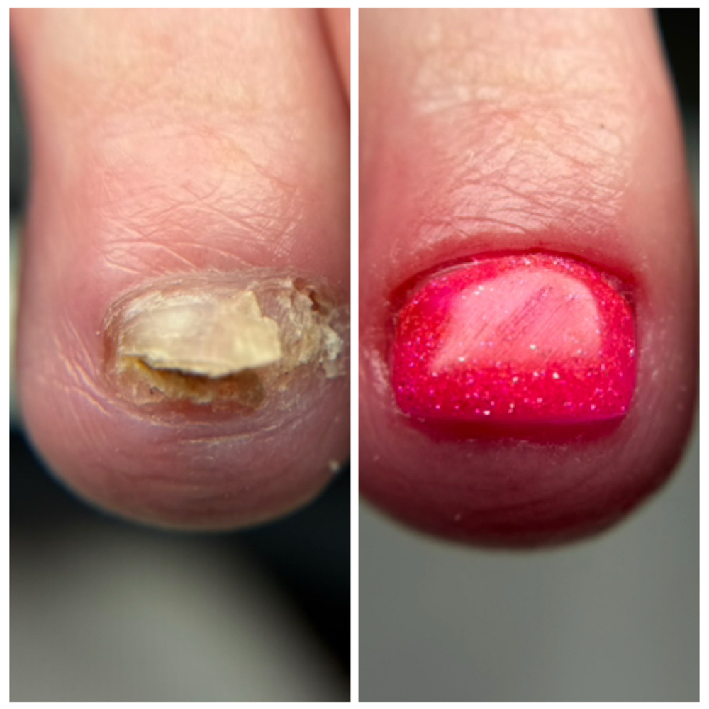 Toenail Reconstruction at Divine Goddess | Wellness Nail Reconstructions in Spring Hill, FL