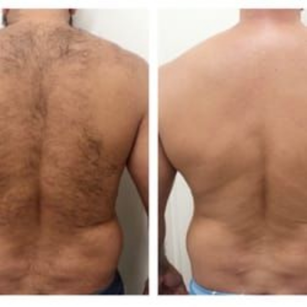 Full Back Wax at Bella Glow Skin and Body in San Antonio, TX