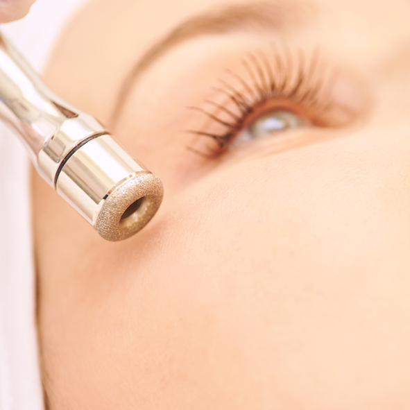 Microdermabrasion Facial