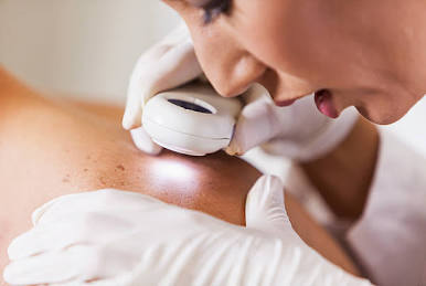 Dermatologist Consult