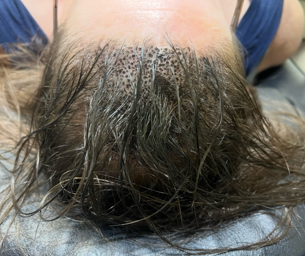 Scalp Micropigmentation at Kacee Battreal - KB Beauty in Desloge, MO