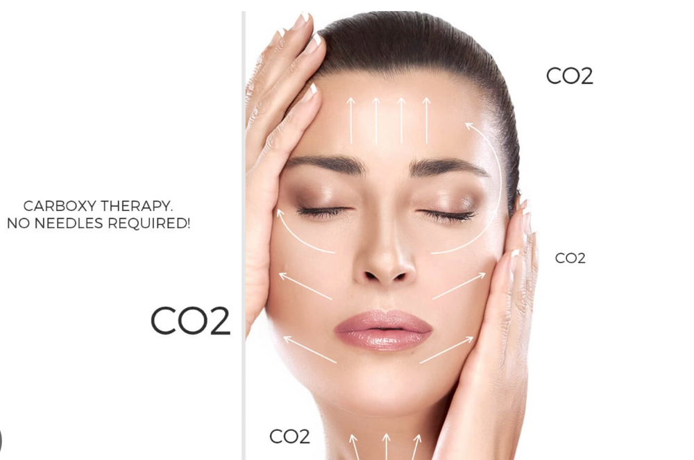 KrX CO2 Carboxy Therapy