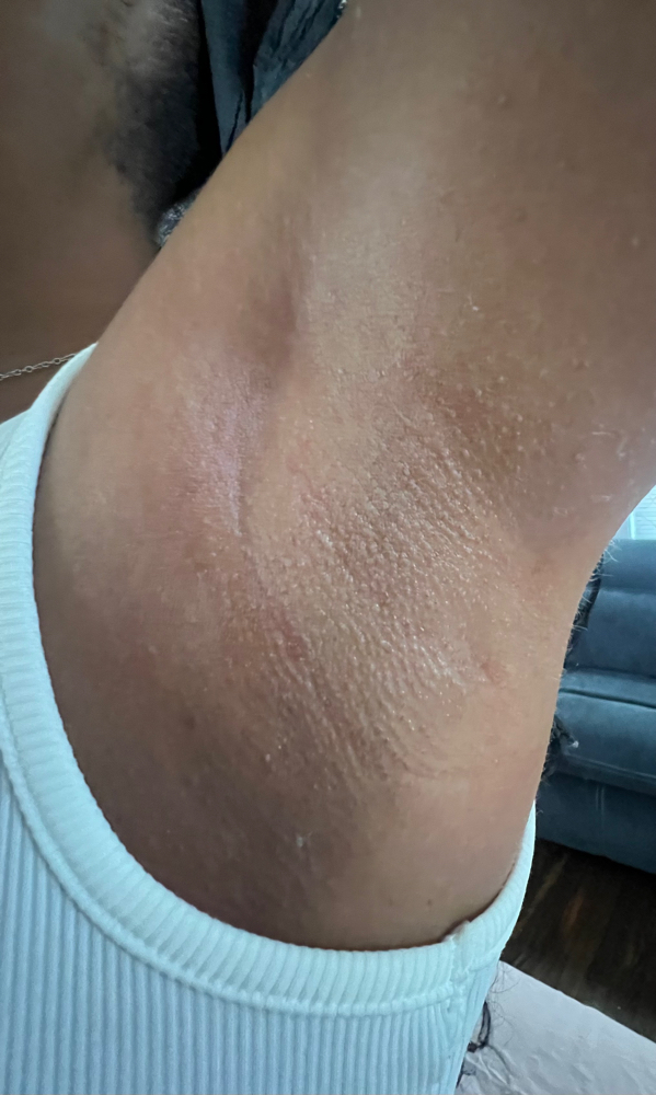 Underarm Wax at Lady Iridium Esthetics LLC