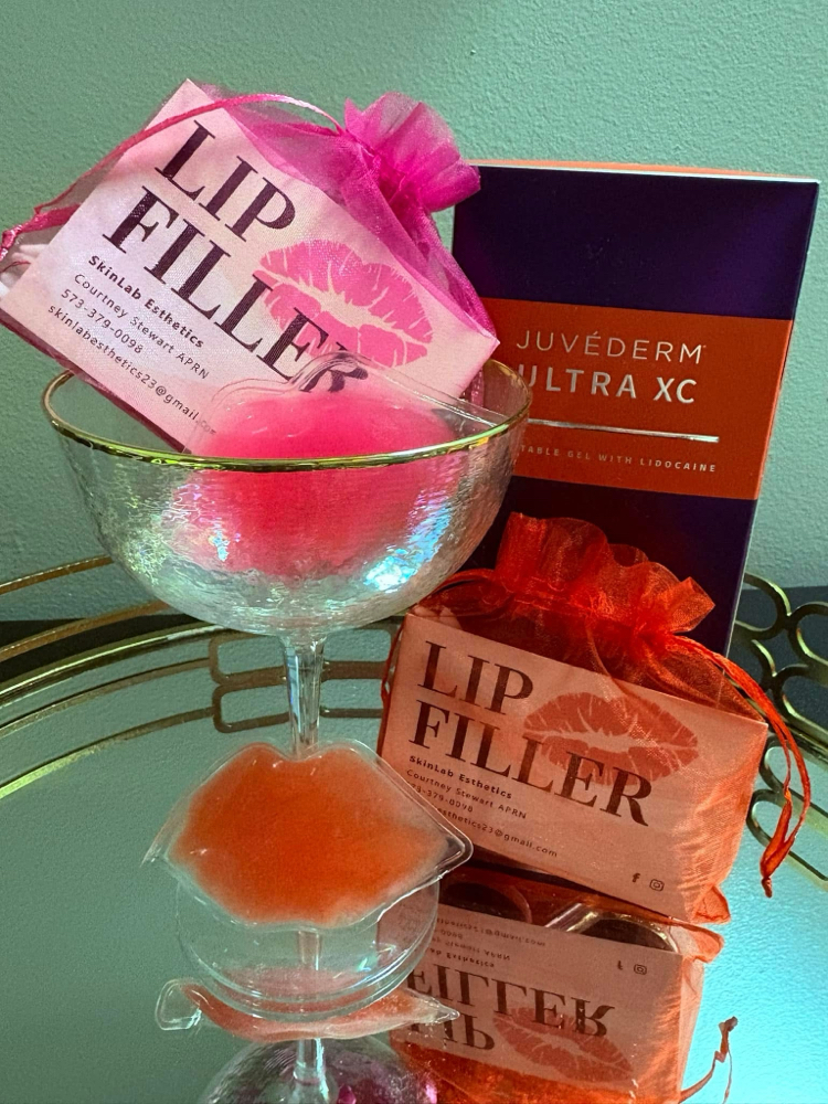 Lip Filler (FRIDAY SERVICE ONLY)