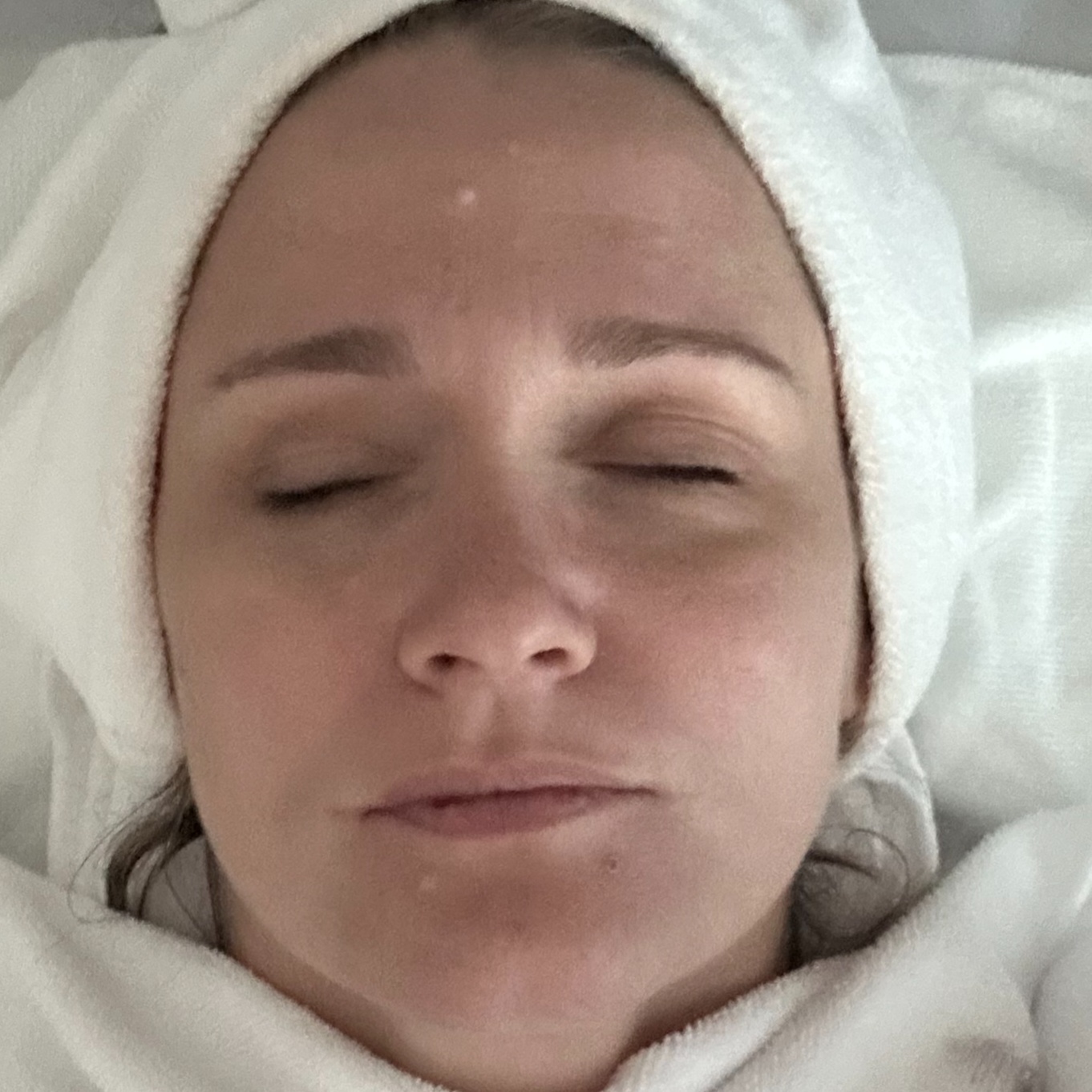 Corrective Acne Facial at Fields Beauty and Wellness in Bradenton, FL