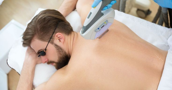 Laser Hair Removal (session)