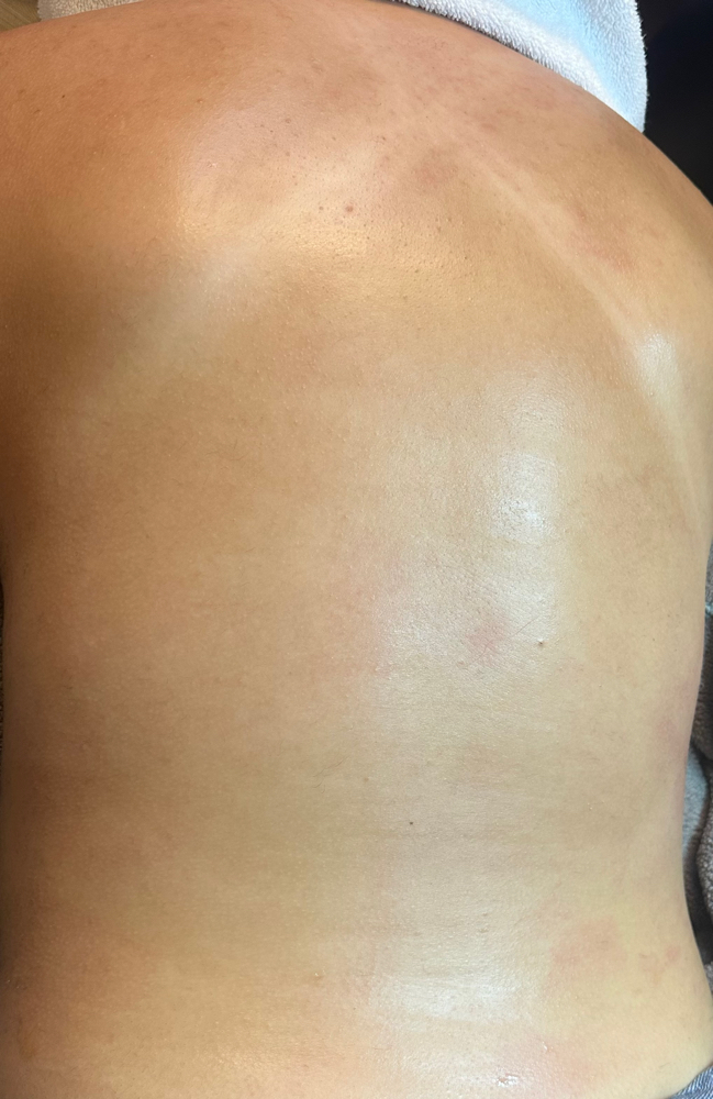 Back/Stomach