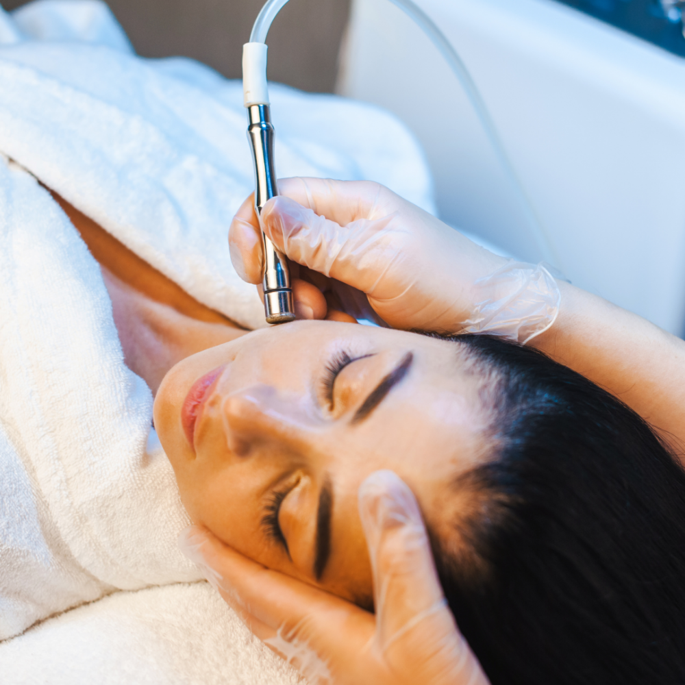 Diamond Microdermabrasion
