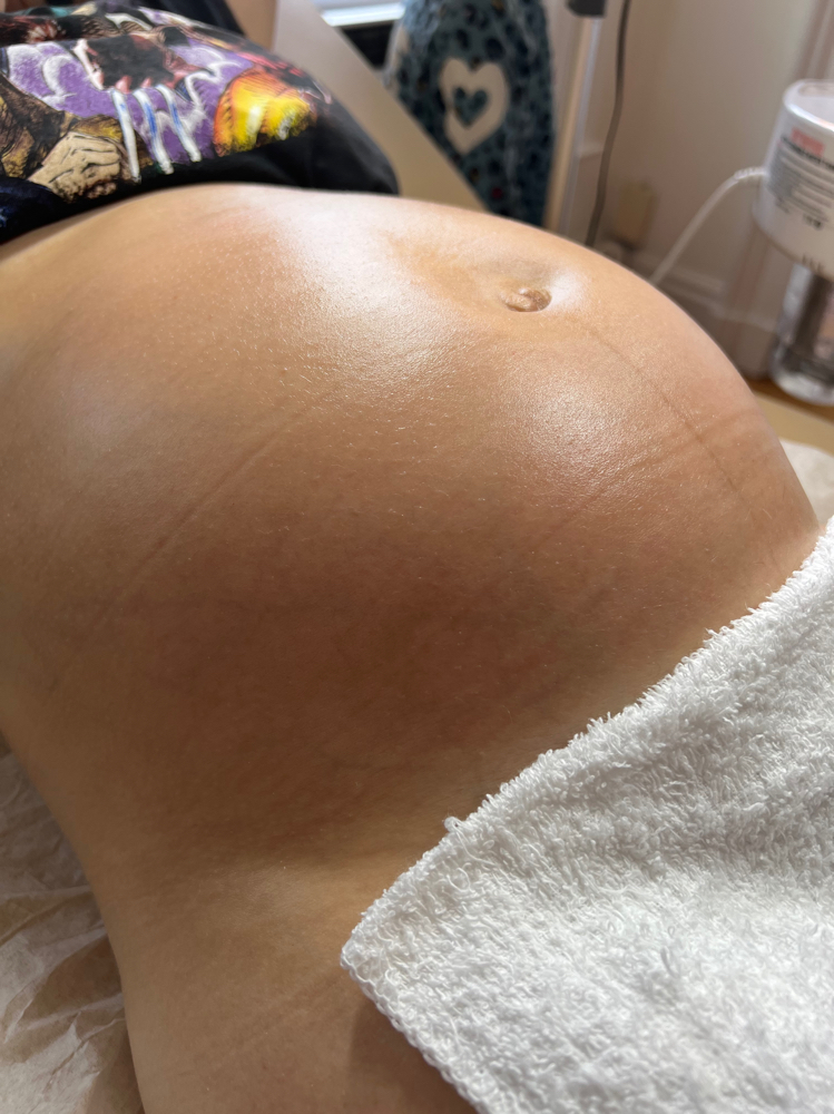 Belly Glow Facial