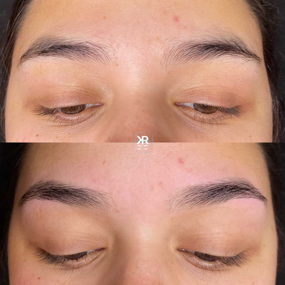 Eyebrow Tweezing