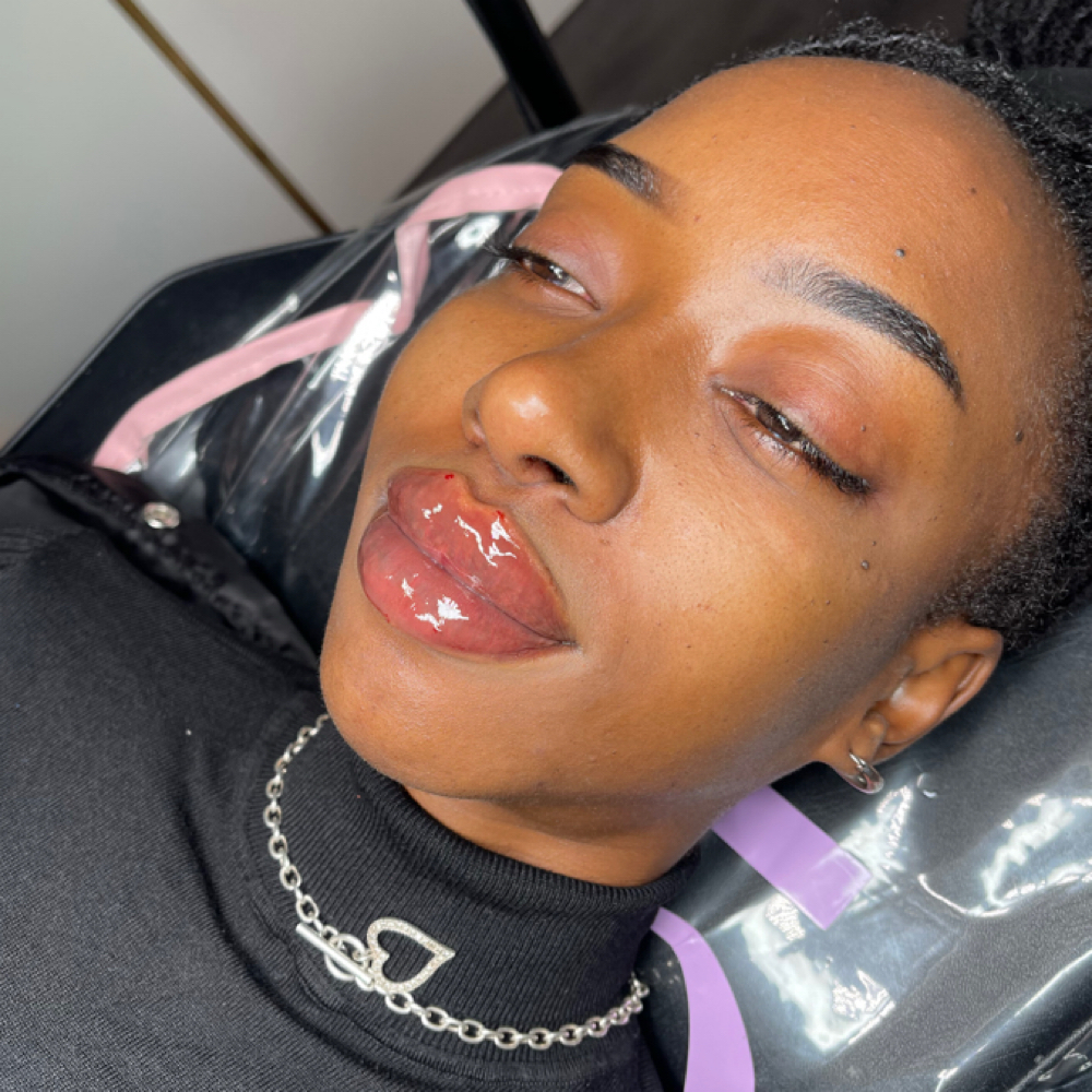 Russian Lip 2.0mL at Sevrae Aesthetics in College Park, GA