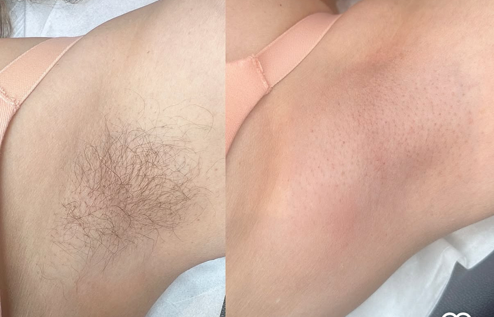 Underarm Wax✨👻