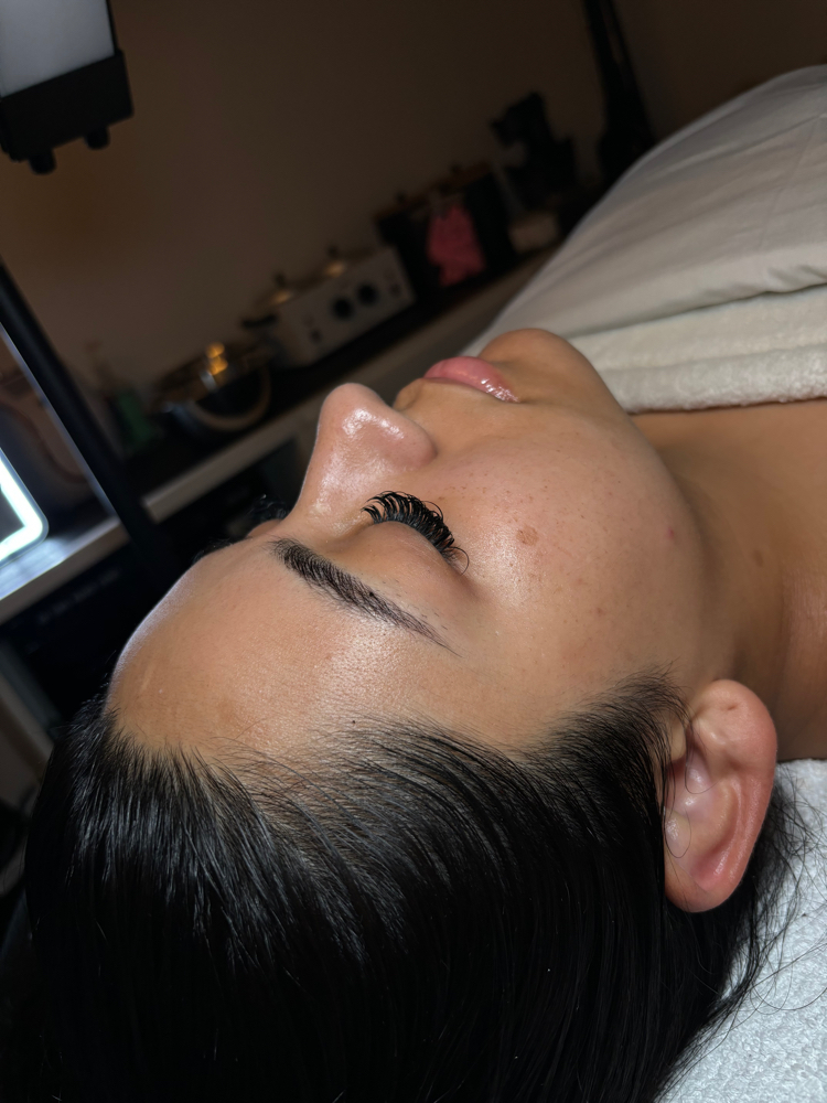 Microdermabrasion Facial